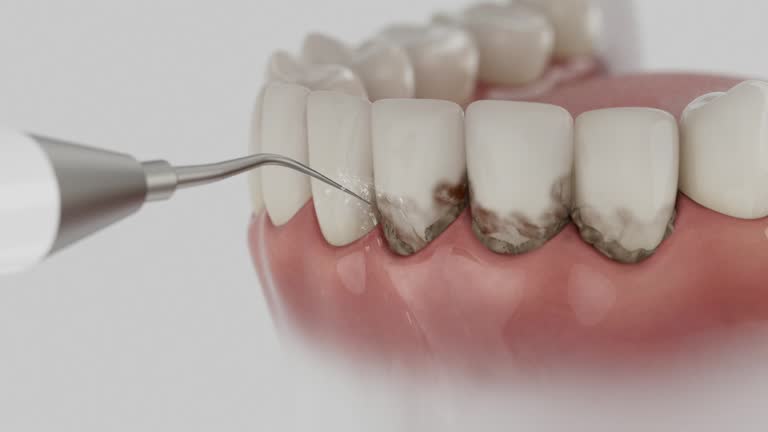 Reliable Tooth Extraction contractor in Wayne County County, GA by Dentist Open Now